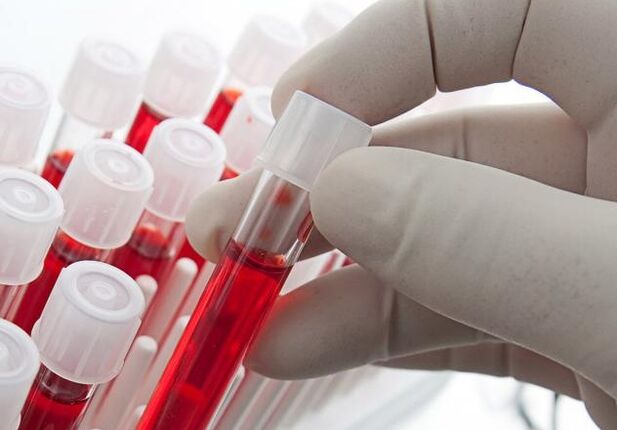 odol azterketa alkohola edan ondoren